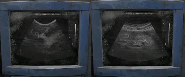 纸嫁衣8千子树第一章夜盲谜题攻略