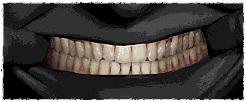 寻找伪人魅魔版直装