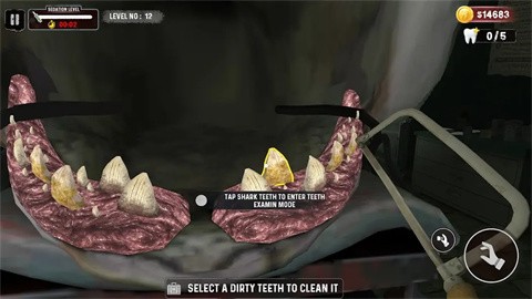 鲨鱼牙医模拟器截图2