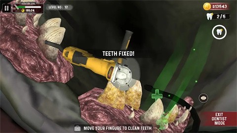 鲨鱼牙医模拟器截图3